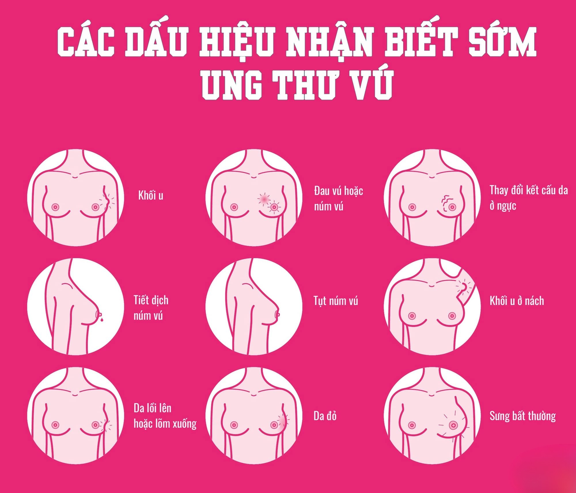 Nhận biết các dấu hiệu ung thư vú để kịp thời phát hiện và điều trị kịp thời