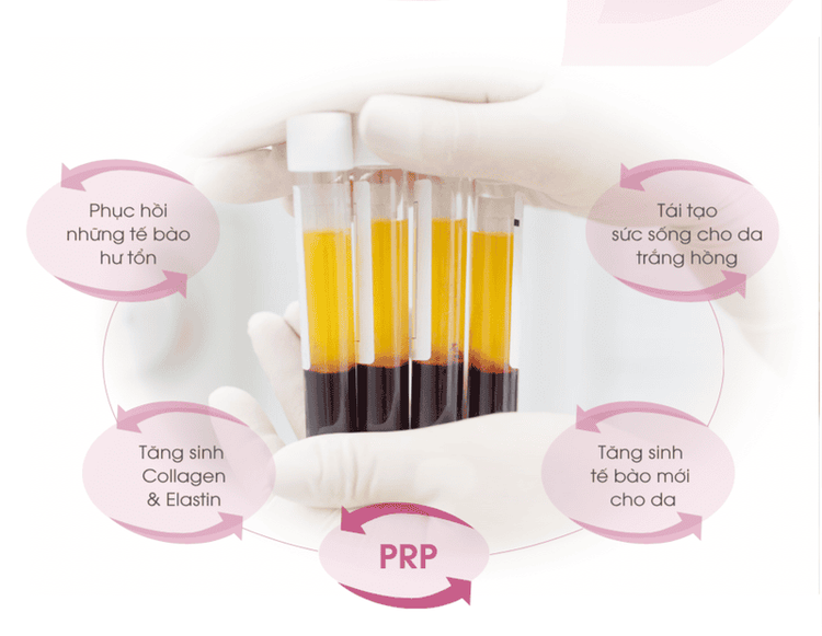 PRP – giải pháp điều trị xương khớp ít xâm lấn, thúc đẩy phục hồi tự nhiên từ bên trong.