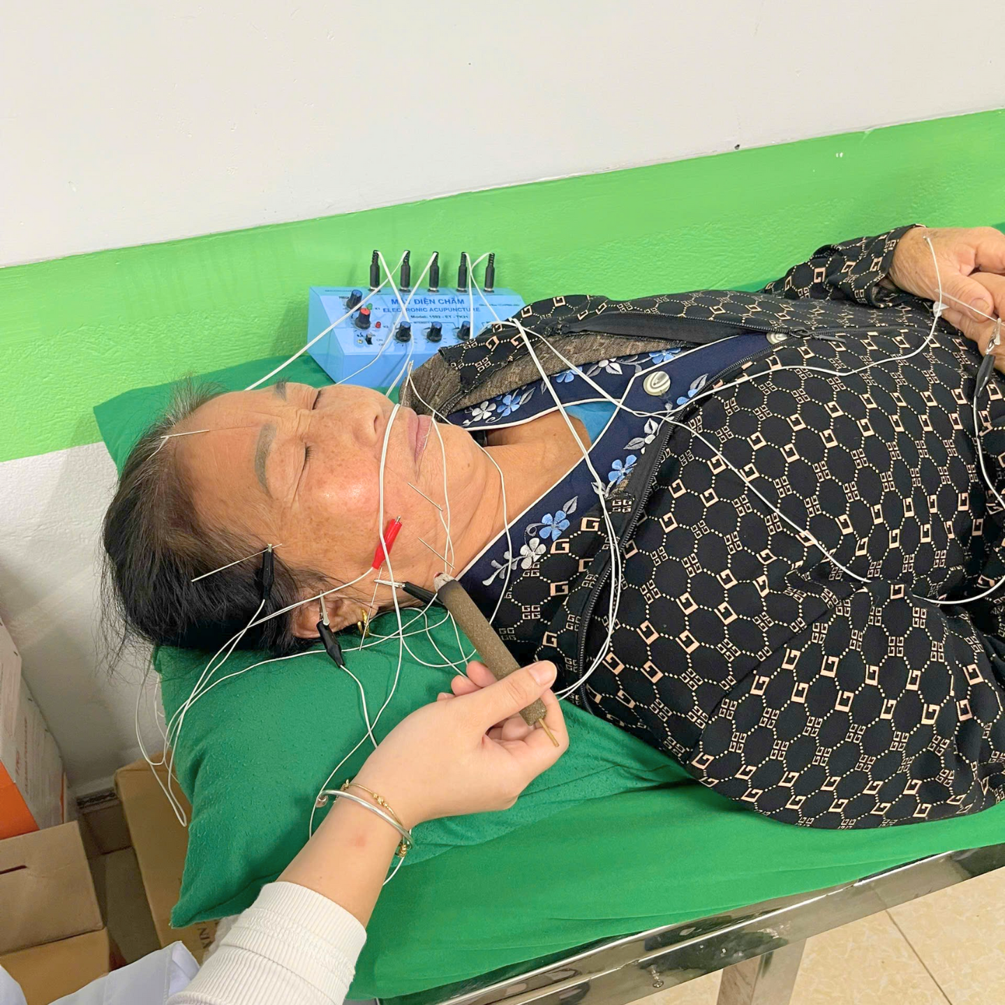 Điều trị liệt dây thần kinh số 7 bằng các phương pháp y học cổ truyền là một trong những phương pháp an toàn, hiệu quả