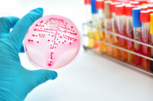 Xét nghiệm chẩn đoán bệnh bạch hầu cần thực hiện càng sớm càng tốt