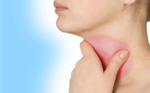 Bướu giáp đơn nhân ác tính