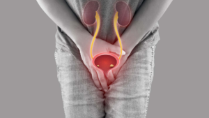 Nhóm đối tượng có nguy cơ mắc bệnh