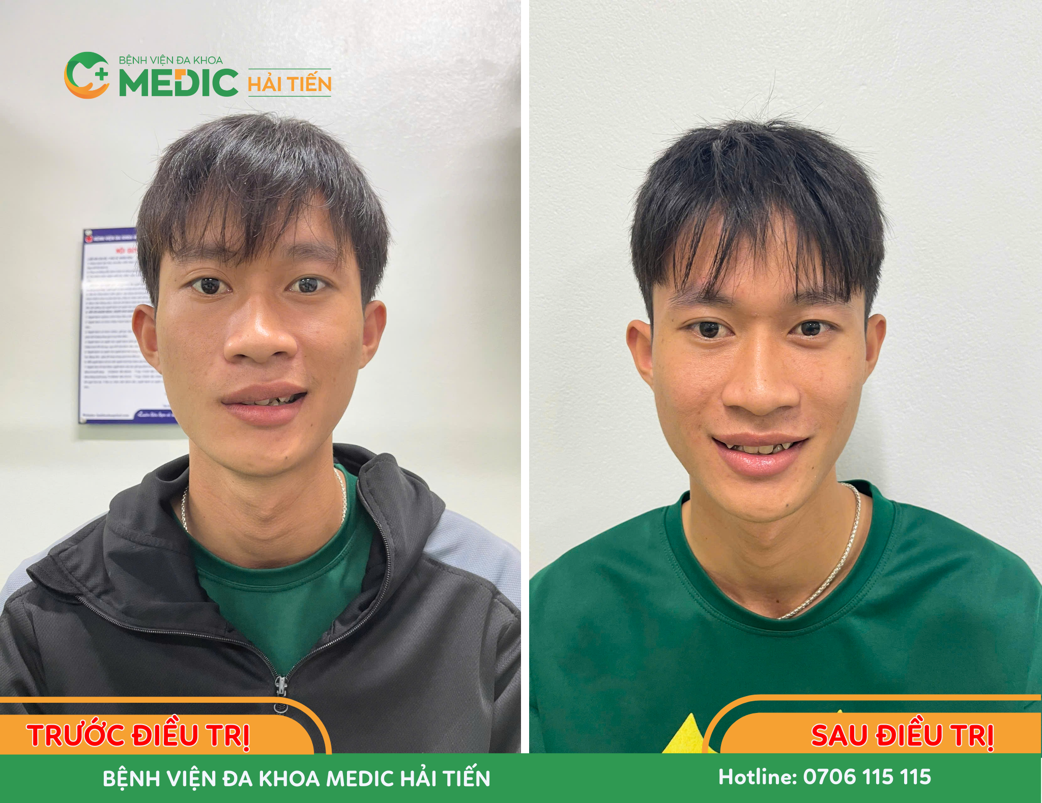Các vấn đề bệnh nhân gặp phải trước khi điều trị đã được cải thiện rõ rệt
