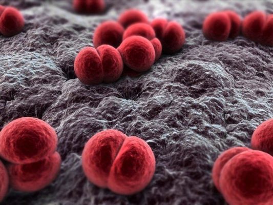 Viêm màng não mô cầu do vi khuẩn não mô cầu Neisseria meningitidis gây ra